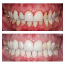 how to improve gum health quickly in ajman