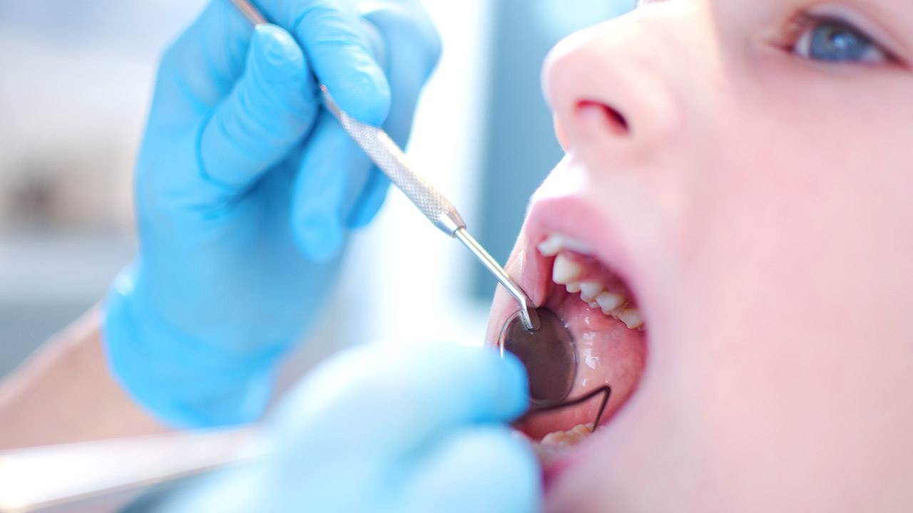 how to take care of teeth with cavities in ajman