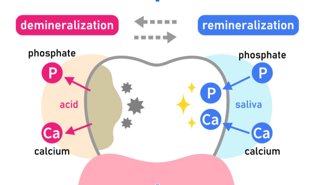 deficiency of which mineral causes tooth decay in ajman uae