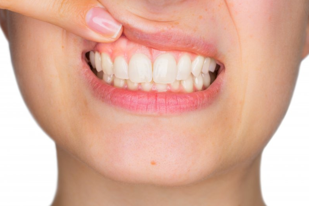 signs of calcium deficiency in teeth in ajman uae