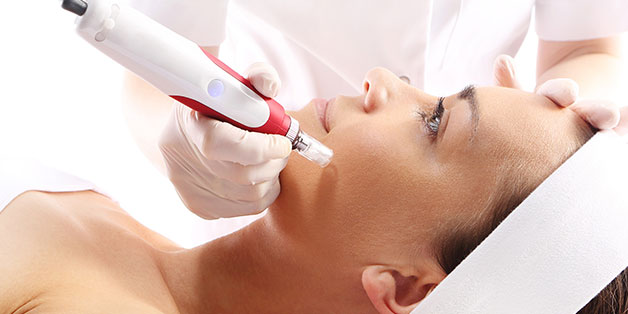 microneedling Ras Al Khaimah