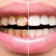 next thumbnail