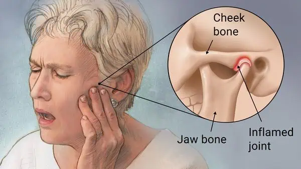 Best TMJ treatment Sharjah