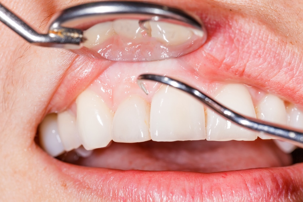 Gum pain dentist treatments near me