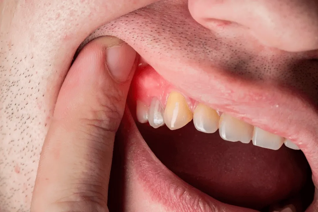 treatments for gum disease in ajman uae