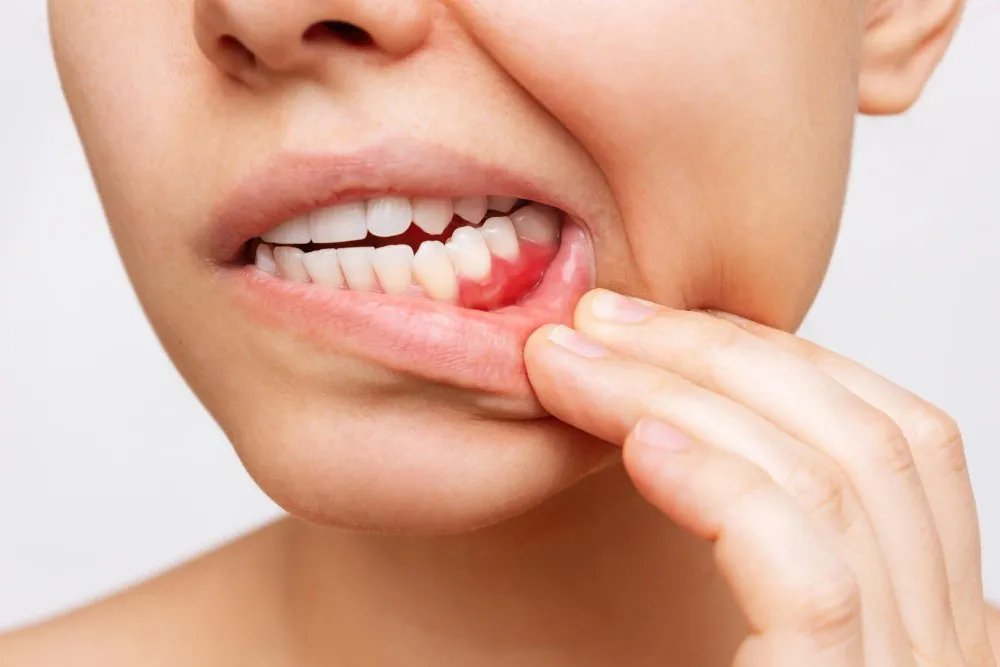 symptoms of having gum diseases in uae ajman