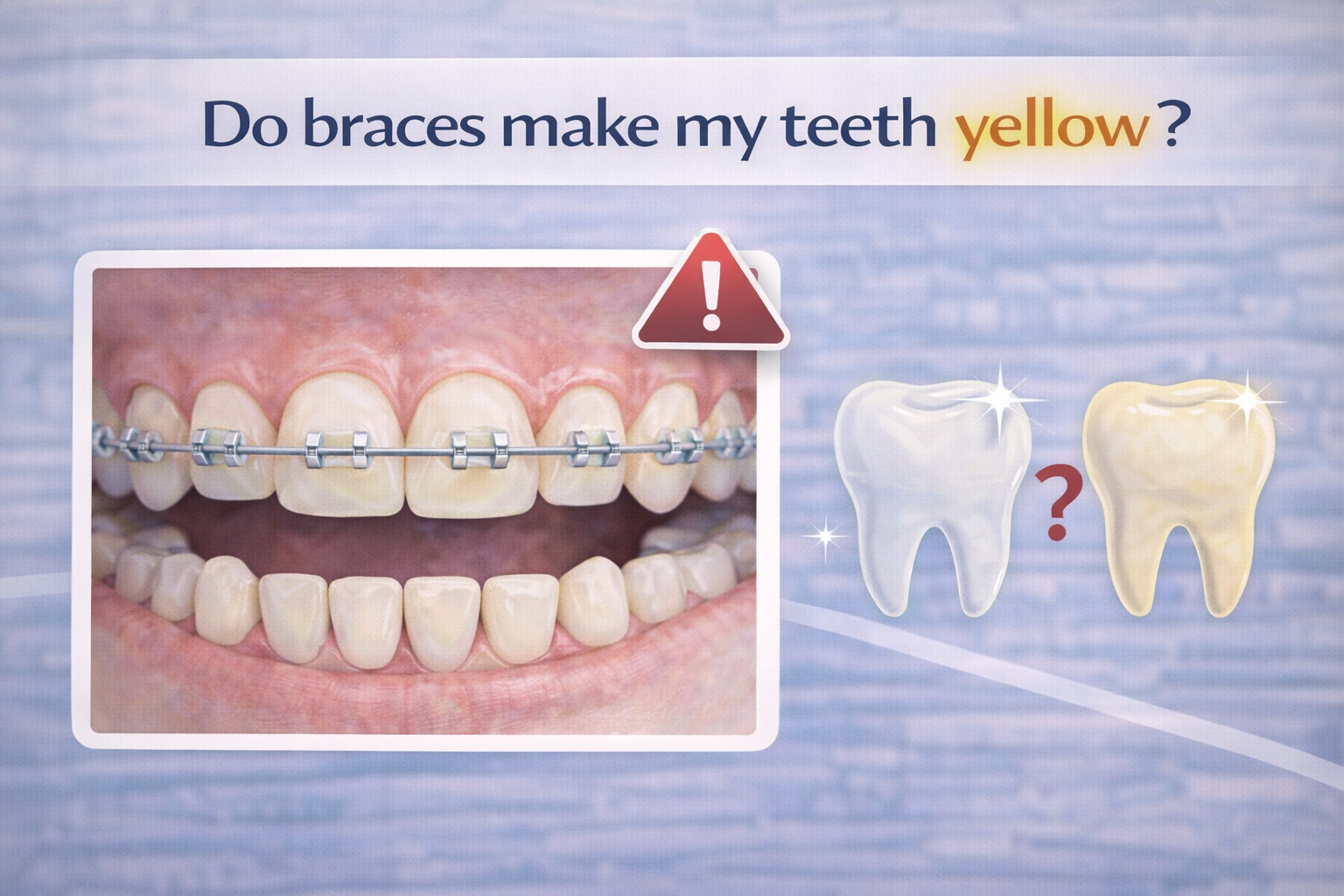 do braces cause yellow teeth