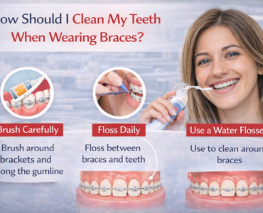 how to clean teeth with braces