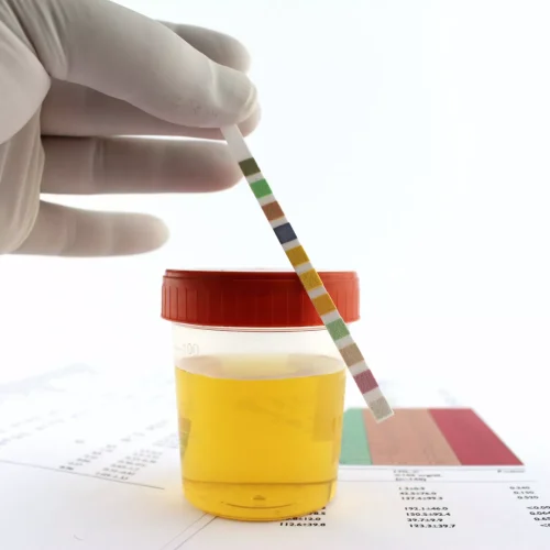 Urine-Test-Pathology-S_M_-Hospital